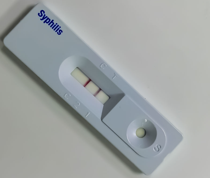 SPhililis Antigen Rest Rest Strip ທົດສອບຢ່າງໄວວາ